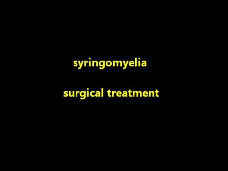 Jamistość rdzenia kręgowego - syringomyelia