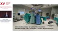 Robotyczne operacje jelita grubego u pacjentów z zespołem kruchości - przełom czy konieczność?