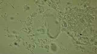 Szyjka macicy - PCT - In vivo - 3h