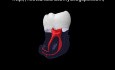 Anatomia systemu kanałowego dolnego zęba mądrości
