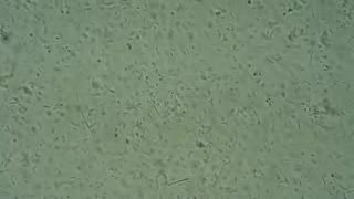Badanie mikrobiologiczne stolca - Lactobacillus spp