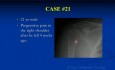 Kurs ortopedii onkologicznej - test nieznanych przypadków klinicznych część C (21-29) - wykład 13