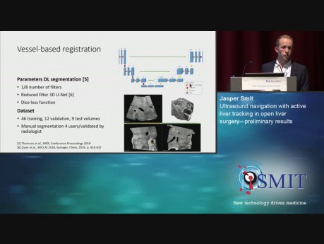 Nawigacja ultrasonograficzna z funkcją Active Liver Tracking w chirurgii wątroby - SMIT 2019