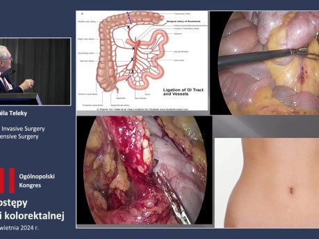 Minimal Invasive Surgery vs Extensive Surgery
