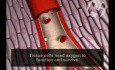 Prawidłowy i ograniczony przepływ krwi