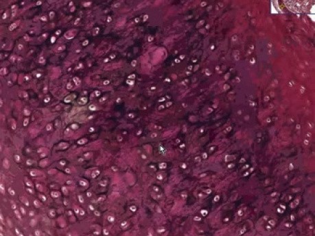 Chrząstka elastyczna - histologia