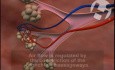 Poumons - anatomie et physiologie