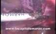 Laparoskopowa histerektomia przy użyciu noża harmonicznego