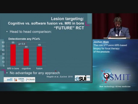 Rola biopsji fuzyjnej w terapii ogniskowej raka gruczołu krokowego - SMIT 2019 