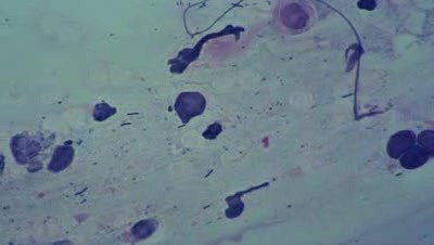 Kanał szyjki macicy - Cytologia