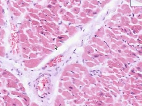 Serce - endo peri epi - histologia