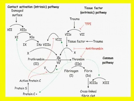 Zaburzenia hemodynamiczne, choroba zakrzepowo-zatorowa i wstrząsy - patomorfologia - część 4g