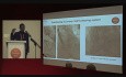 Zastosowanie systemu Medtronic EvolutR w leczeniu natywnej zastawki aortalnej