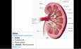 Differentialdiagnostik einer Nephrolithiasis mittels Ultraschall