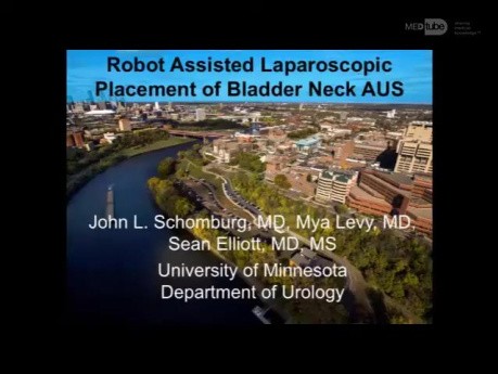 Implantacja sztucznego zwieracza cewki moczowej w asyście robota chirurgicznego