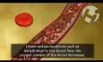 Anemia sierpowata (niedokrwistość sierpowata)
