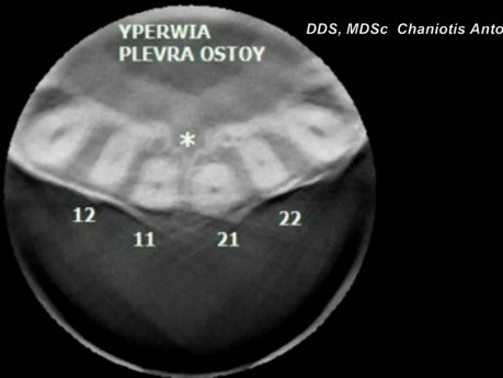 Endodoncja - zastosowanie CBVT