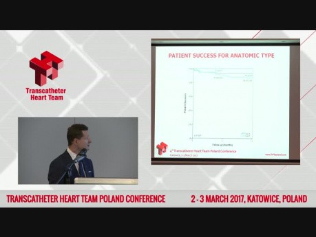 Transcatheter Mitral Valve Repair using NeoChord System