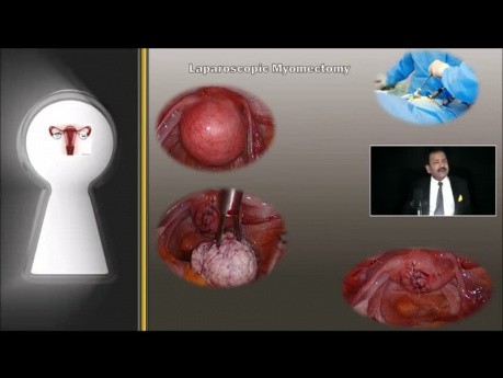 DR RK Mishra Live Stream- wprowadzenie do chirurgii mało inwazyjenej