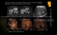 Diagnostyka obrazowa chorób wątroby - WZW, PSC, AIH, PBC