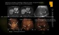 Bildgebende Diagnostik bei folgenden Lebererkrankungen: Hepatitis, Leberfibrose,  Leberzirrhose, PSC, AIH, PBC