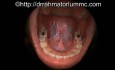 Anatomia ludzkiego dna jamy ustnej i języka