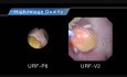Ureterorenoskopia giętka - URF-V2 Superslim 8.4Fr 