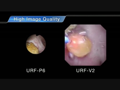 Ureterorenoskopia giętka - URF-V2 Superslim 8.4Fr 