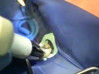 Szynowanie - periodontologia