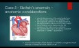 Studium przypadków wrodzonych wad serca i zastawek