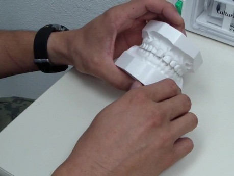 Przypadek Ortodontyczny #2 - Przegląd Głównych Problemów z modelami