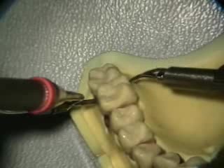Symulacja endoskopowa debridementu (UL Palatal, Facial)