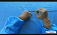 Wacik laparoskopowy
