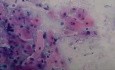 Kanał szyjki macicy - Cytologia